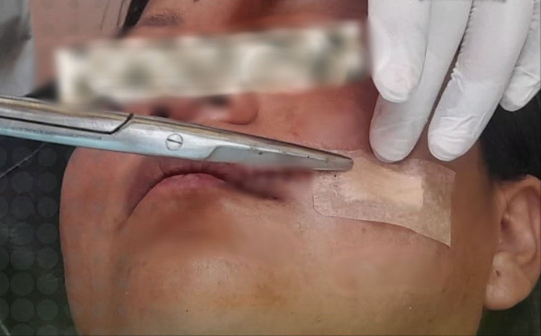 Mujer con heridas en el rostro denuncia que fue atacada con un cuchillo por su pareja
