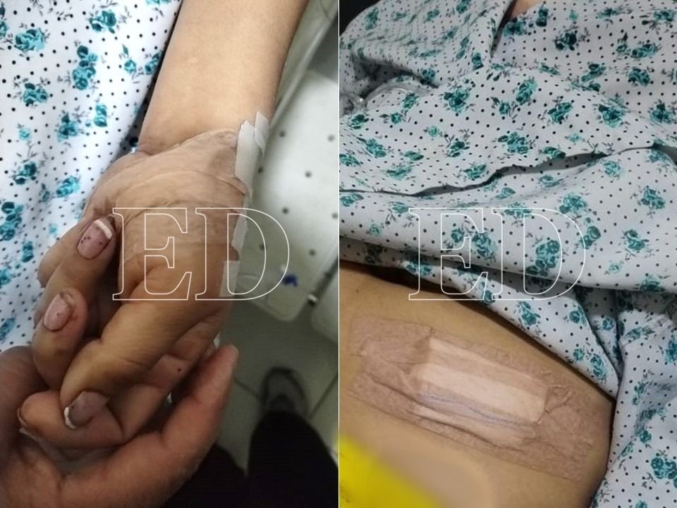 "Tengo miedo que salga libre": una mujer fue apuñalada diez veces y corre riesgo de perder la visión