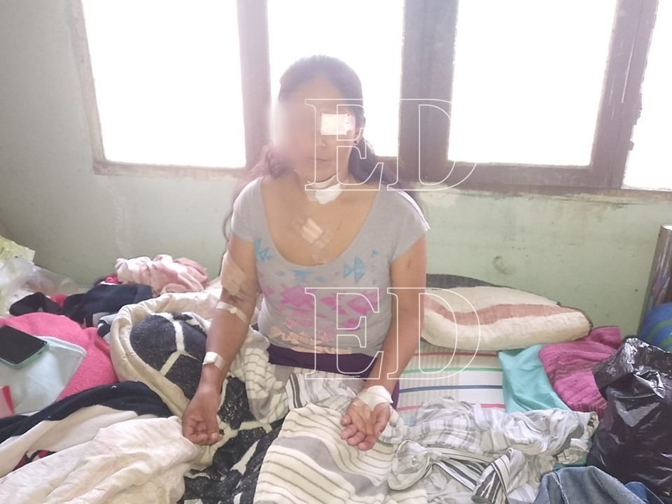 "Tengo miedo que salga libre": una mujer fue apuñalada diez veces y corre riesgo de perder la visión