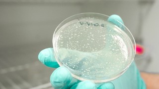 EEUU registra casi 2.000 casos de Cyclospora, un parásito que causa diarrea "explosiva"